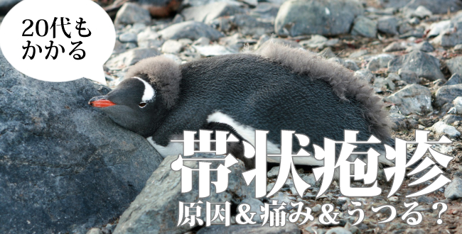 20代もかかる帯状疱疹-原因や痛み・うつるかについて